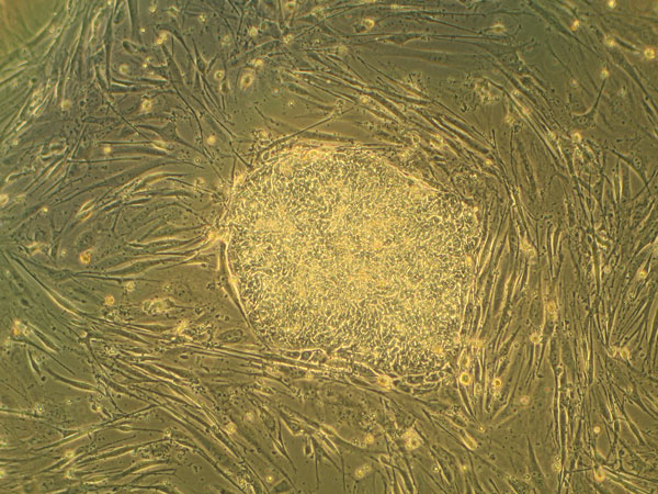 Stem cell extracellular vesicles to turn off ischemic inflammation